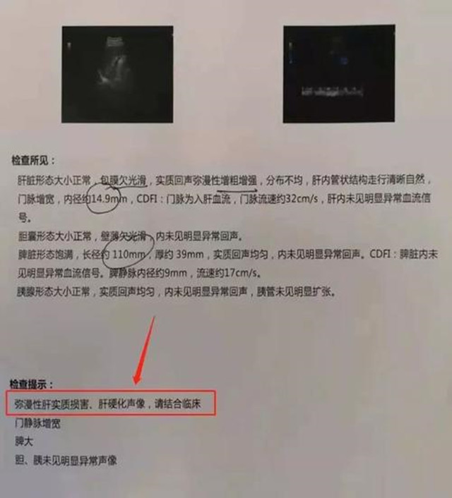 50歲河南男子堅持每晚“喝2兩白酒”，如今身體怎么樣了？